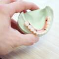 3 Coisas Que Precisa De Saber Antes De Fazer Implantes Dentários