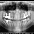 A importância da ortopantomografia